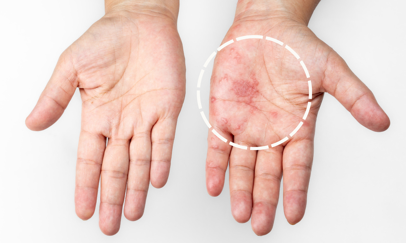 진단키트 활용한 신속 처방 시스템