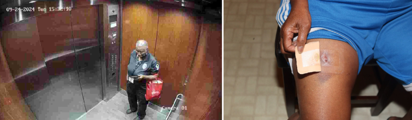 검찰이 재판 과정에서 증거로 제시한 아파트 CCTV 영상 및 허벅지 상흔. 검찰은 CCTV에 찍힌 인물이 피해자를 살해한 직후의 용의자라고 주장했으며 허벅지 상처는 피해자와의 몸싸움으로 생긴 것이라고 했다.