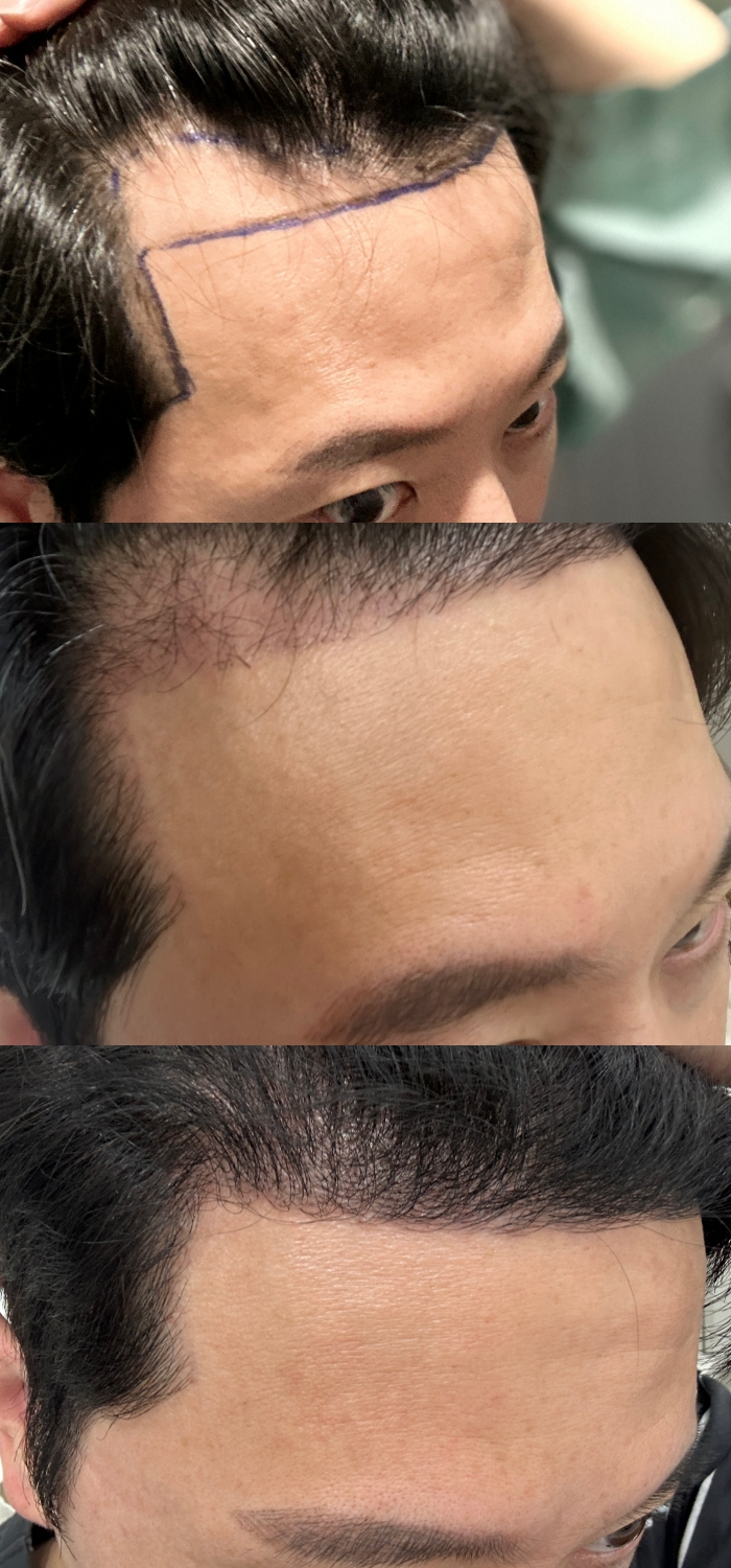 [Image by Noonopi Plastic Surgery]
