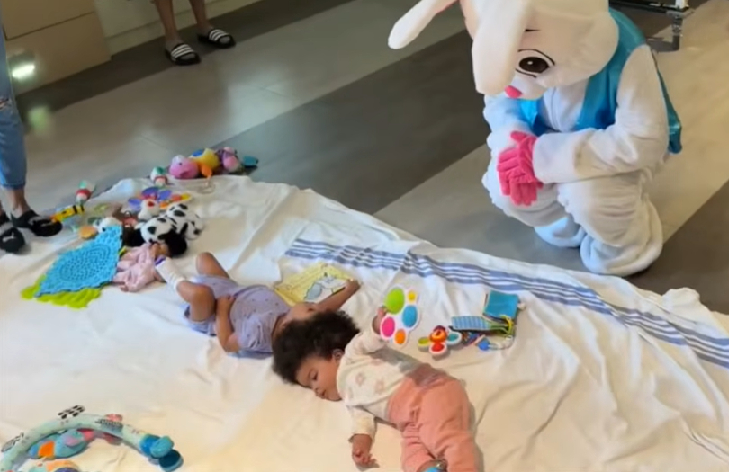 머리가 붙은 채 태어난 쌍둥이 자매 히얍과 우흐브토. [SSM Health Cardinal Glennon Children’s Hospital/ABC7 캡쳐]
