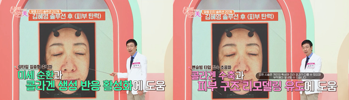 [채널A ″뷰티클리닉 터치미″ 방송 화면]
