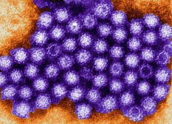 노로바이러스 [Charles D. Humphrey, USCDCP]